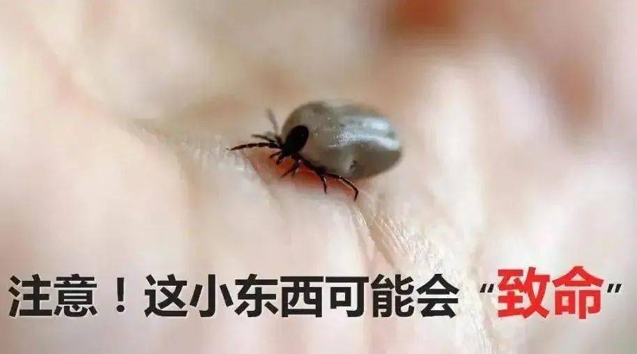 電子體溫計(jì) 電子體溫計(jì)